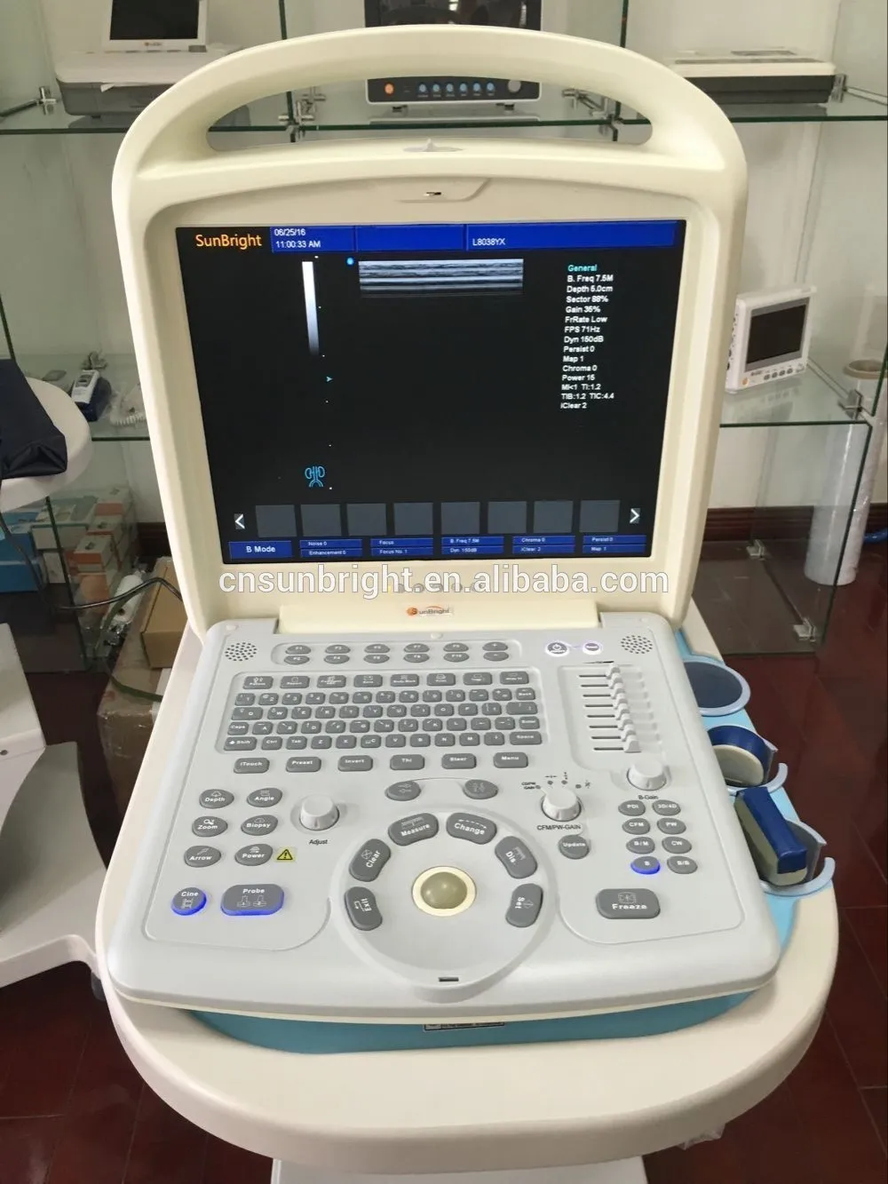 цветно доплеровское ултразвуково медицинско оборудване CE portable digital color doppler ultrasound/ниската цена на скенер, доплер на ултразвуков апарат